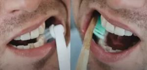 Dental Care Brushing