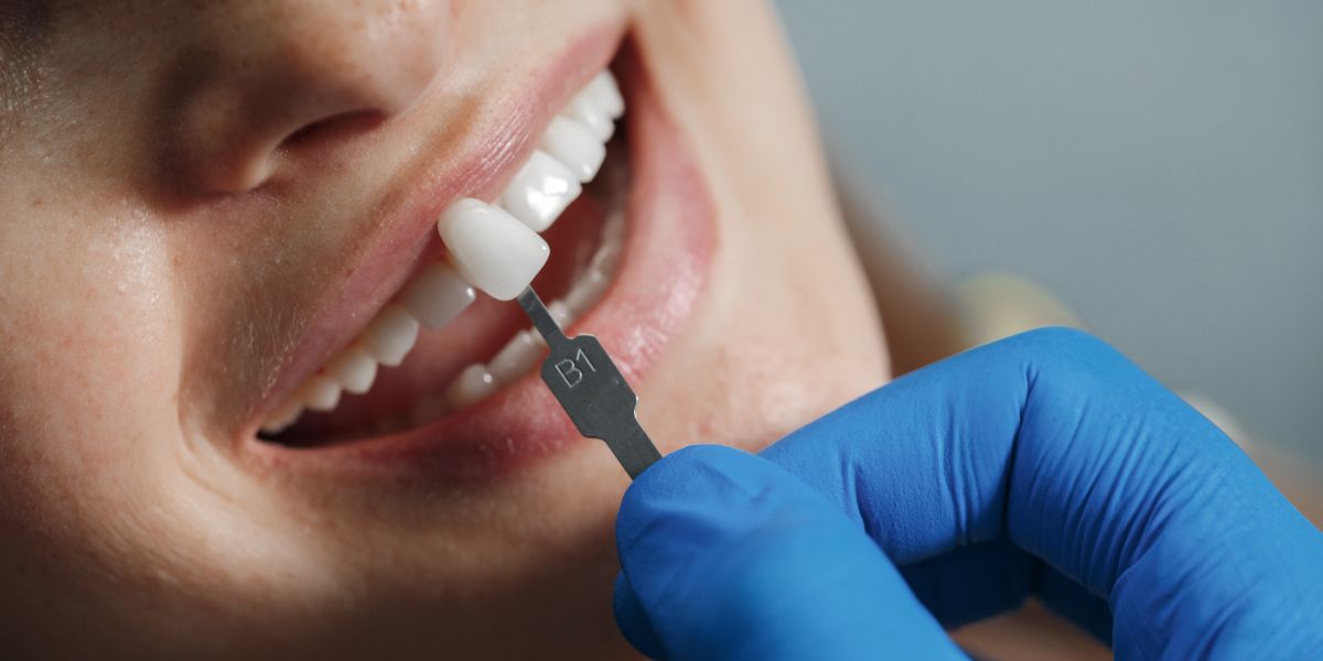 Advanced Countries for Veneers Dental Restoration in Dentistry MediDentCare